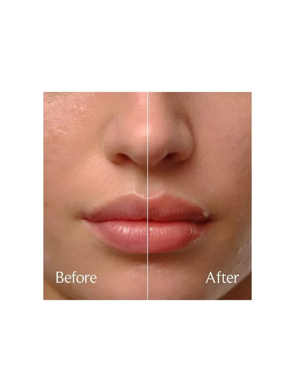 NEW Fresh Sugar Soft Lips Set • Coconut Lip Balm & Sugar Treat Lip Oil in Honey